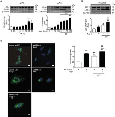 Angiotensin II-Regulated Autophagy Is Required for Vascular Smooth Muscle Cell Hypertrophy